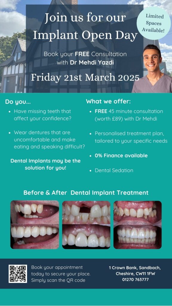 Cheshire Dental Implants Open Day at Crown Bank Dental